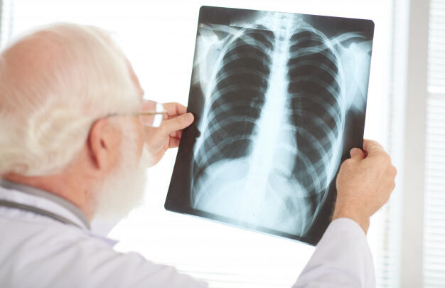 É possível fazer consulta com pneumologista online?