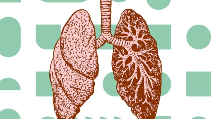 O que é embolia pulmonar?