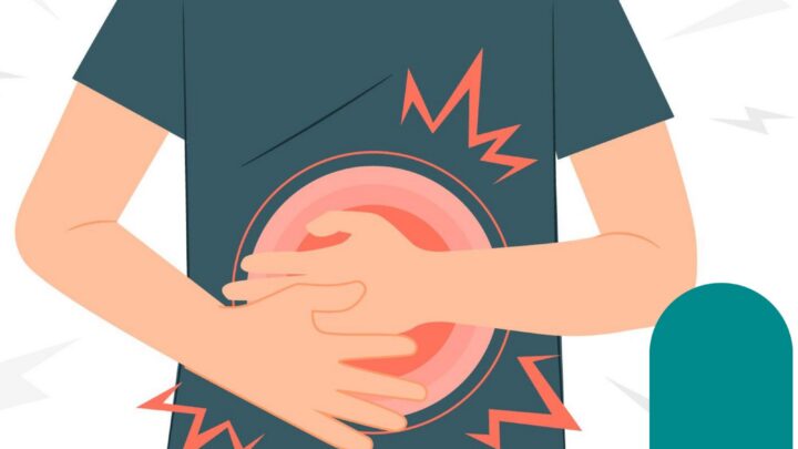 A cirurgia de Hérnia Inguinal por videolaparoscopia