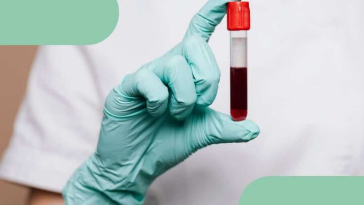 Exame toxicológico para caminhoneiros: na Kompa Saúde tem!